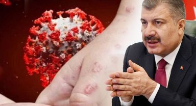 Eris varyantı Türkiye'de