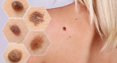 "Ben"im var diye sevinmeyin! Kanser olabilirsiniz