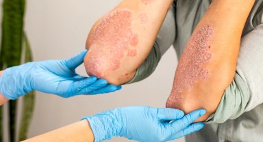 Bursa'da mantar uyarısı