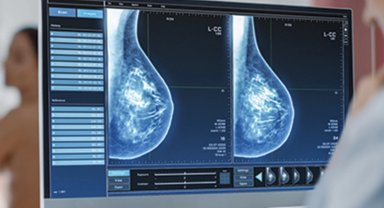 "Mamografi erken tanı ve tedavi için önemli"