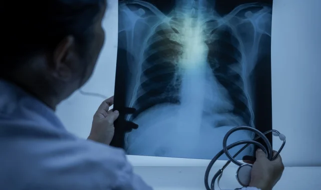 Uzm. Dr. Kılıçlı: Zatürre toplum sağlığı için büyük tehdit