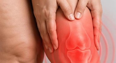 Diz biyomekaniğini bozan süreç: Lipödem