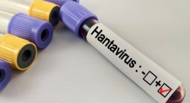 Hantavirüs salgına dönüşür mü? Kapalı alan temizliğinde büyük risk