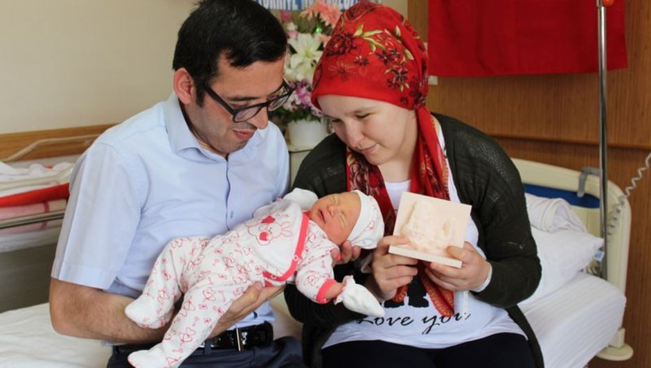 3 boyutlu Ebrar Tuğba bebek, dünyaya gözlerini açtı