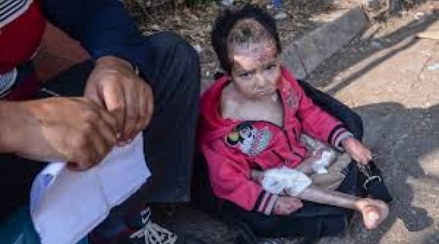 Avrupa'nın Vicdanı Onu Arıyor
