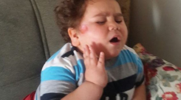Çitos Efe'ye Nazar Değdi