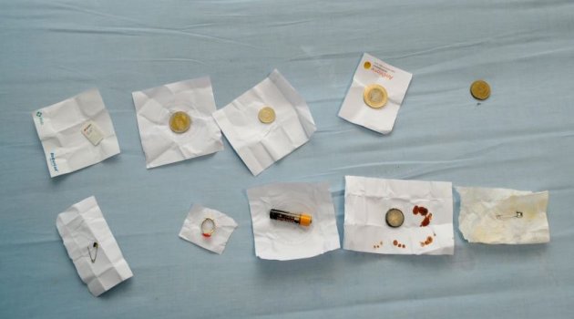 Çocuklar en çok para ve pil yutuyor