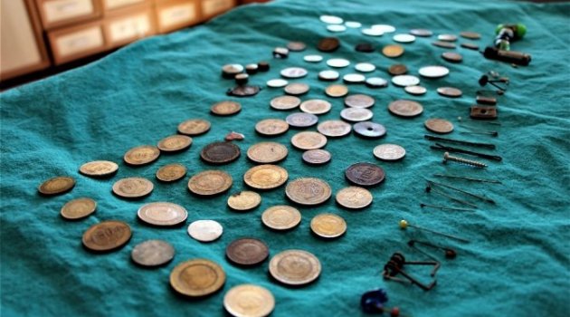 Çocukların midesinden çıkanlar şaşırttı
