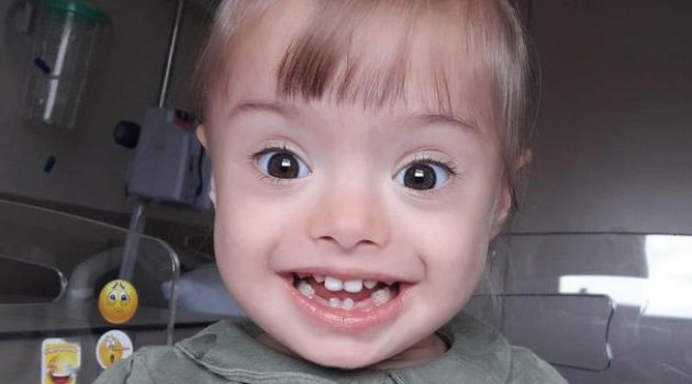 Minik Eylül Yardım Bekliyor