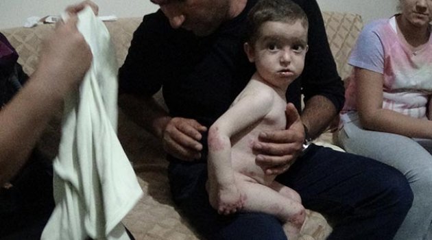 Minik Muhammet Kendine Uzanacak Yardım Elini Bekliyor