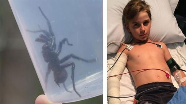 Örümceğin Isırdığı Çocuk Panzehirle Kurtarıldı