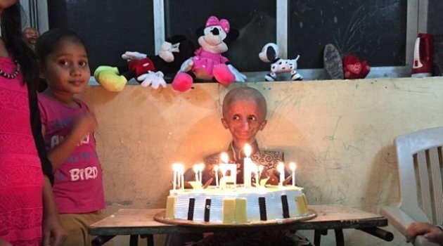 Progeria Hastası Çocuk 15. Yaşını Kutladı
