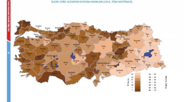 Sezaryen Oranı Yüzde 52'lere Yükseldi; En Çok Sezaryen Yüzde 73 ile Tunceli'de