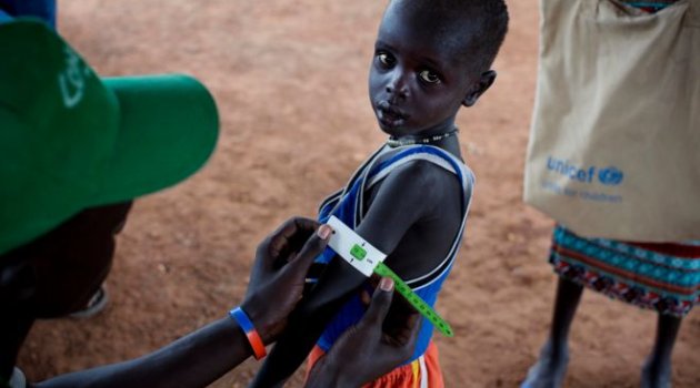 UNICEF: 1,4 Milyon Çocuk Açlıktan Ölebilir
